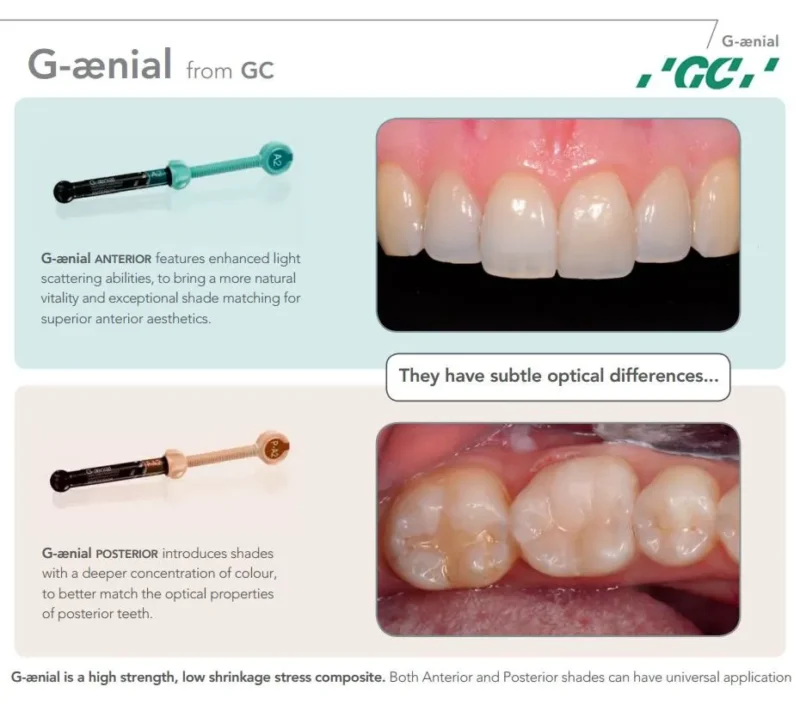 GC G-Aenial Anterior | Dental Product At Lowest Price