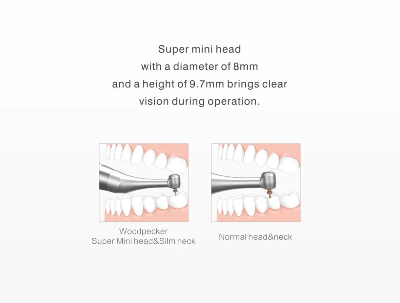 Woodpecker Motopex-M Endo Motor (2 Packet Wal-Flex Free) | Dental Product at Lowest Price