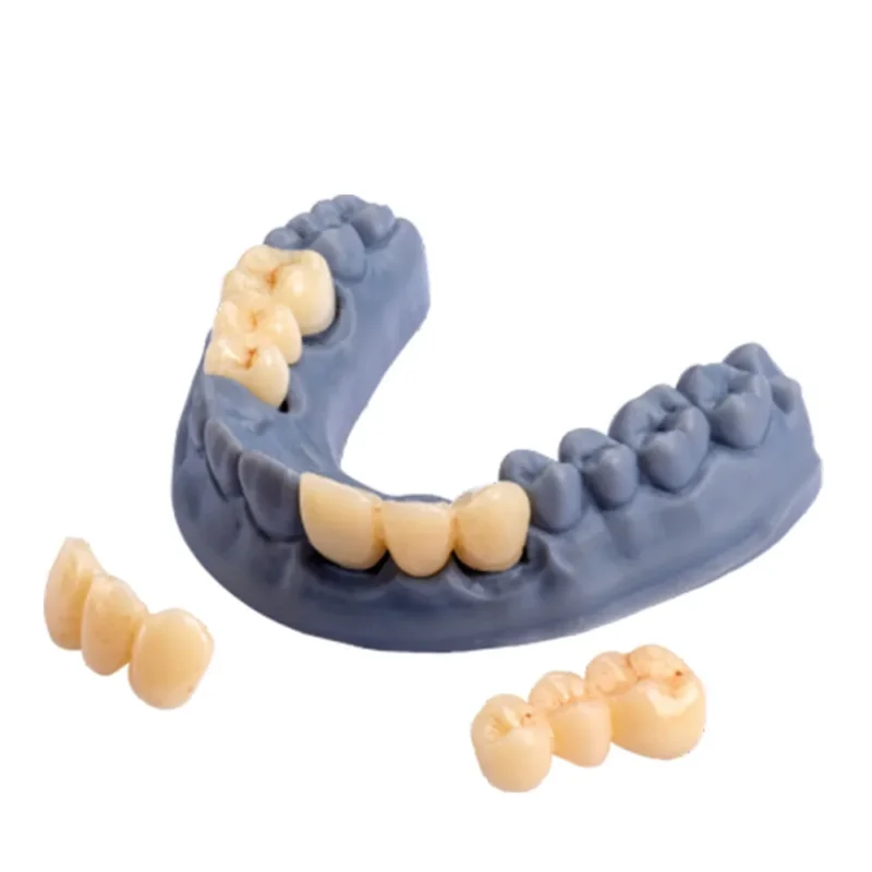 D-Tech 3D Accuprint Crown & Bridge Pro 3D Printing Resin | Dental Product at Lowest Price