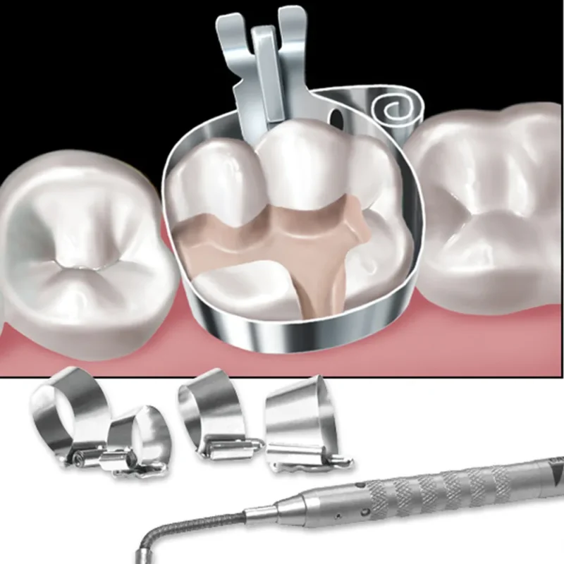 Dentsply AutoMatrix Refills | Dental Product at Lowest Price