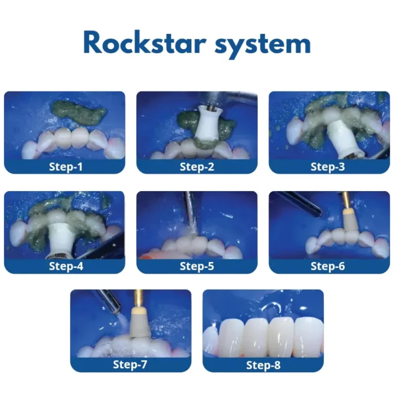 Bioclear Rockstar Polisher Kit | Dental Product at Lowest Price