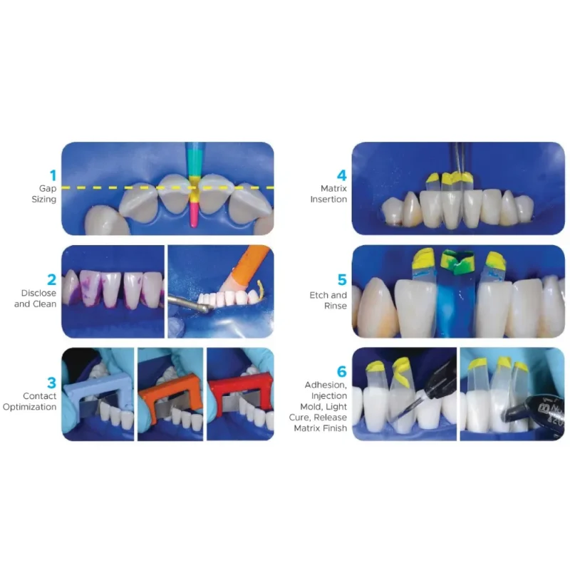 Bioclear TruContact Saw Kit | Dental Product at Lowest Price