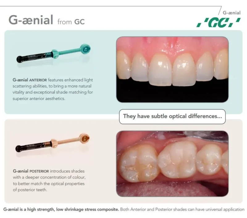 GC G-Aenial Anterior - Image 6