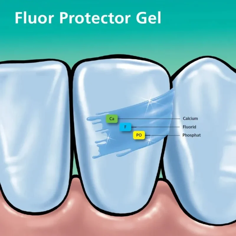 Ivoclar Fluor Protector (Pack Of 1) - Image 2