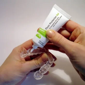 Ivoclar Fluor Protector Gel - Image 5