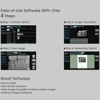 Eighteeth X Ray Graphic RVG Sensor Size 2 - Image 6