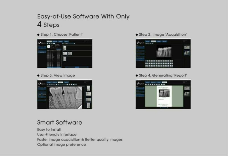 Eighteeth Nano Pix X Ray Graphic RVG Sensor Size 1 - Image 7