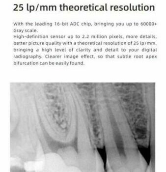 Woodpecker i- Sensor X-Ray Size 2 - Image 2
