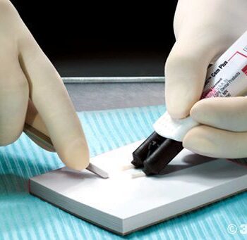 3M ESPE Relyx Luting 2 Luting Cement Refill Packs - Image 3
