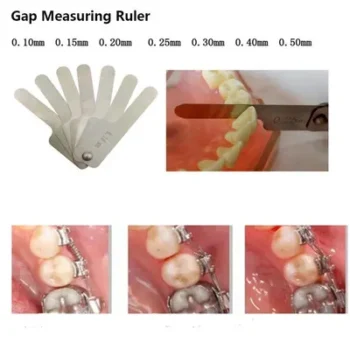 Orthodontic Inter-proximal Gauge - Image 5