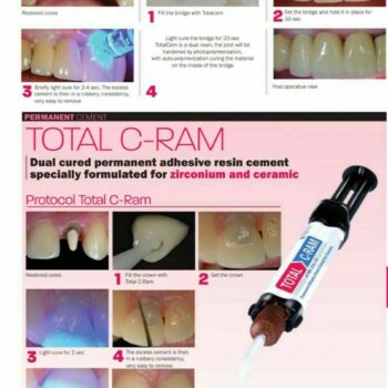 ITENA Total C-Ram Self-adhesive Resin for metal, all ceramic, zirconium - Image 2