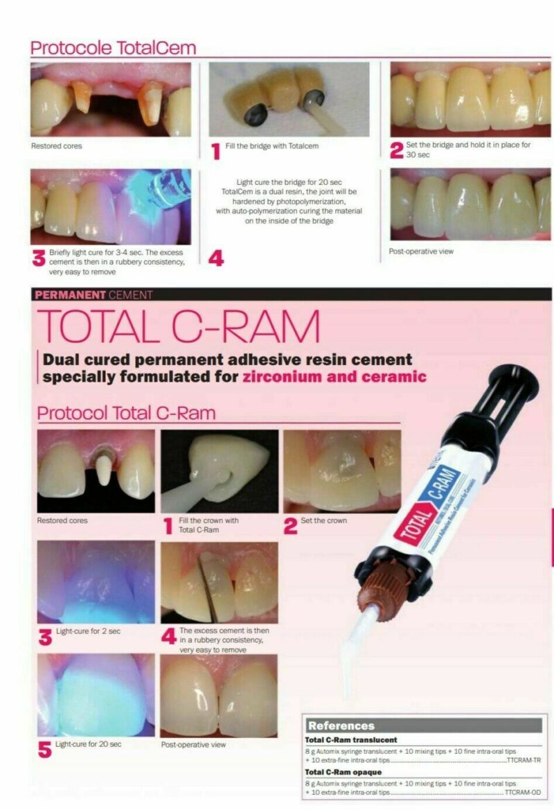 ITENA Total C-Ram Self-adhesive Resin for metal, all ceramic, zirconium - Image 2