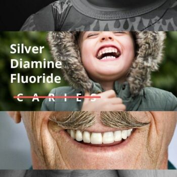Dengen Caries Arrest Silver Diamine Fluoride 38% - Image 5