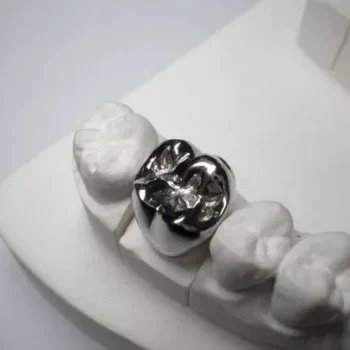 Dentsply StarLoy N Alloy Metal - Image 5