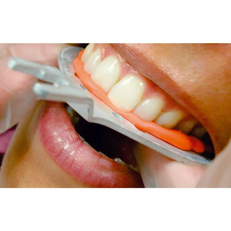 Prime Dental Bite Registration Putty - Image 3