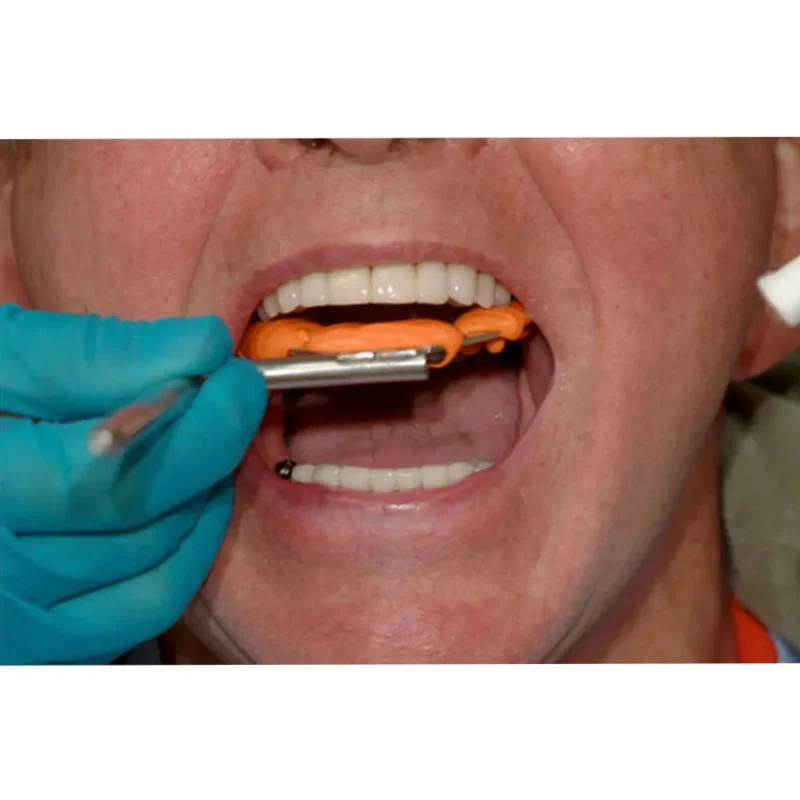 Prime Dental Bite Registration Putty - Image 2