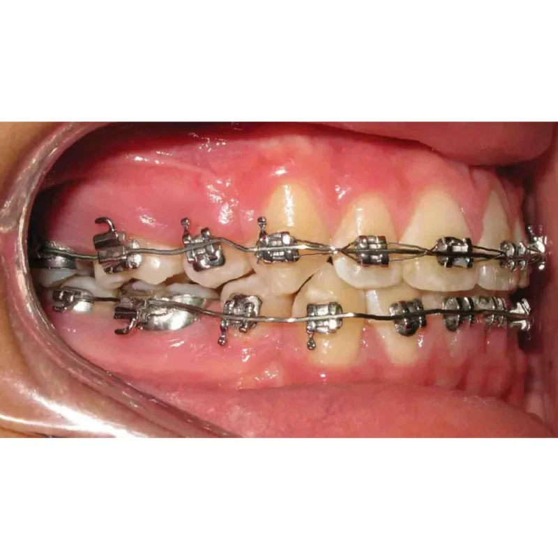 D-Tech Platinum Plus (Mini Twin Bracket) - Image 3