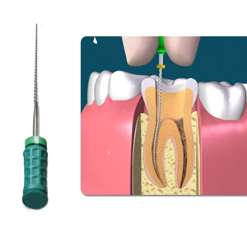 Dentsply M-Access K-Files 31mm (Hand Operated Files) - Image 6