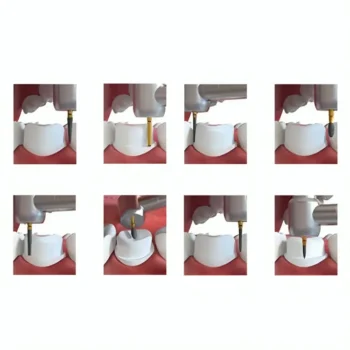 Coltene Crown Preparation Kit IN60013857 - Image 2