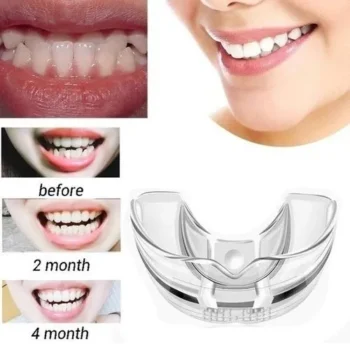 Orthodontic Trainer & Retainer - Image 5