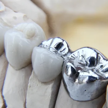 Dentsply StarLoy N Alloy Metal - Image 4