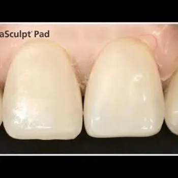 Ivoclar Vivadent OptraSculpt Starter Kit & Refills - Image 5