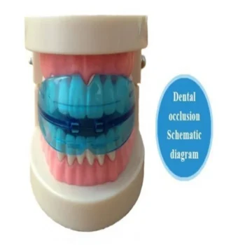 Orthodontic Trainer & Retainer - Image 2