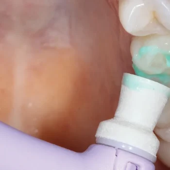 Dentsply Prisma Gloss Polishing Paste - Image 3