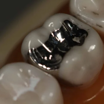 Dpi Fine Grain Silver Alloy - Image 4