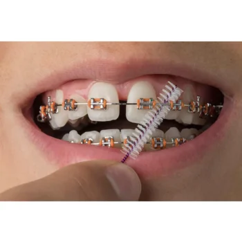 D-Tech Precimax (MIM MBT Prescription Brackets) - Image 3