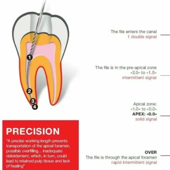 Dentsply Propex Pixi Apex Locator - Image 3