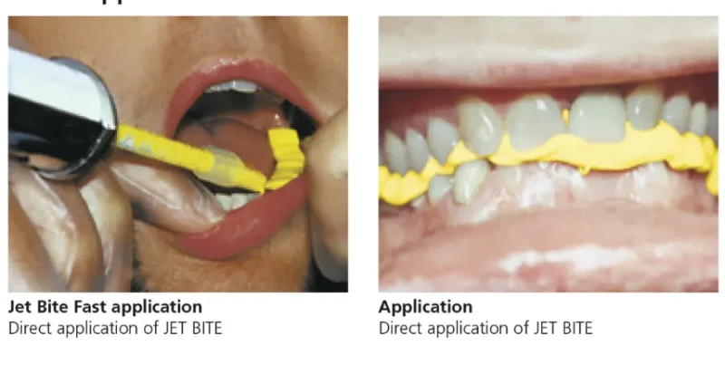 Coltene Jet Bite - Image 3