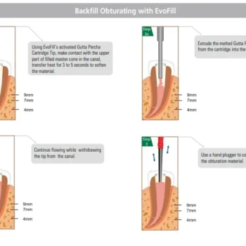 Diadent EvoFill Gutta Percha Cartridges - Image 5