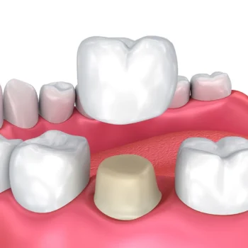 GC Tempron - Image 2