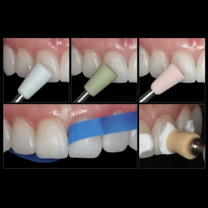 Dentsply Prisma Gloss Polishing Paste - Image 2