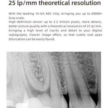 Woodpecker RVG Intraoral Digital X-ray RVG Sensor - Image 2